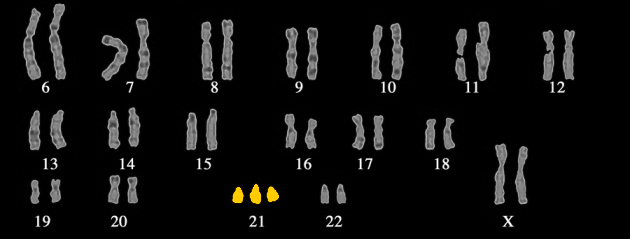 chromosomy